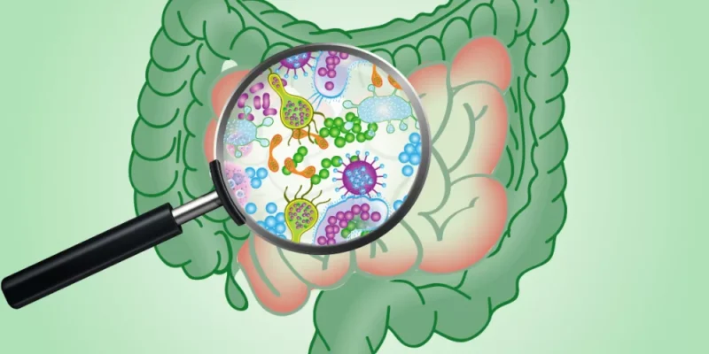SIBO: o que é, sintomas, diagnóstico e tratamento